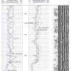 Section of common Sonic Log presentation. Log used to determine formation water saturation, regional water levels, formation properties and fractures. 
(Includes Variable Density Waveform, Sonic Velocity, Short Normal Resistivity, Long Normal Resistivity, Guard Resistivity, Gamma Ray, Line Speed)